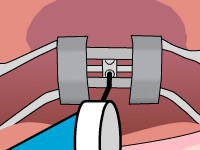 thumb-ortho-palatal-03